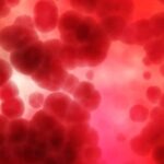 Ways to Treat Iron Deficiency
