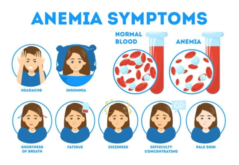 Ways to Treat Iron Deficiency Anemia Symptoms